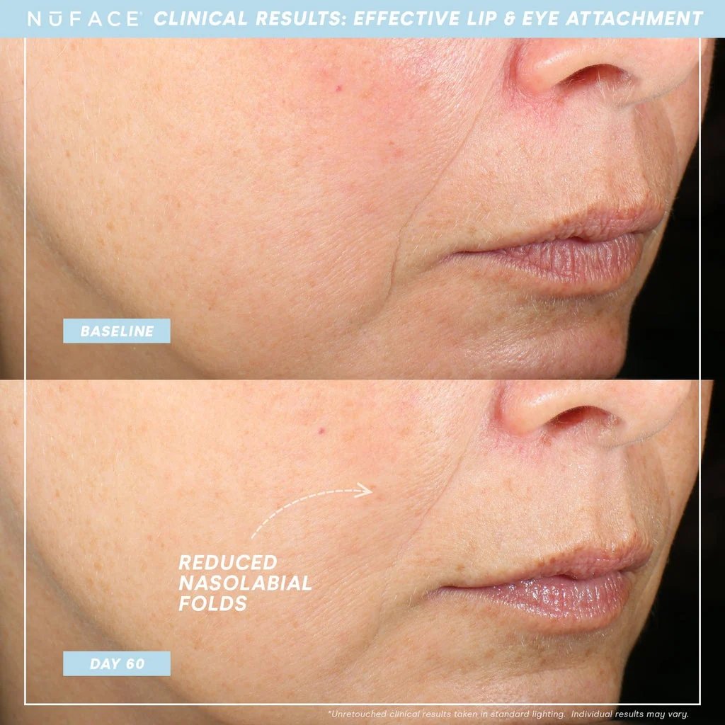 NuFACE TRINITY+ Lip & Eye Attachment 4