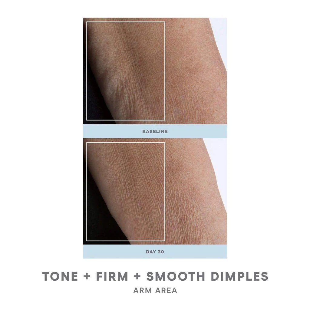 NuBODY SKIN Toning Device 4