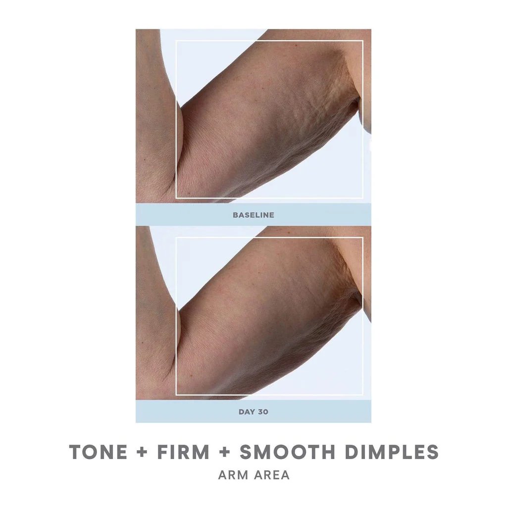NuBODY SKIN Toning Device 5