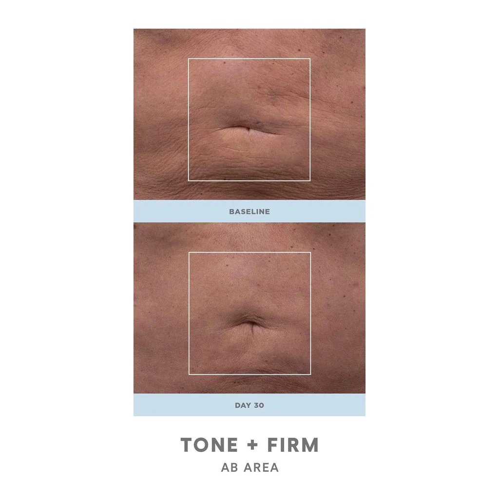 NuBODY SKIN Toning Device 6