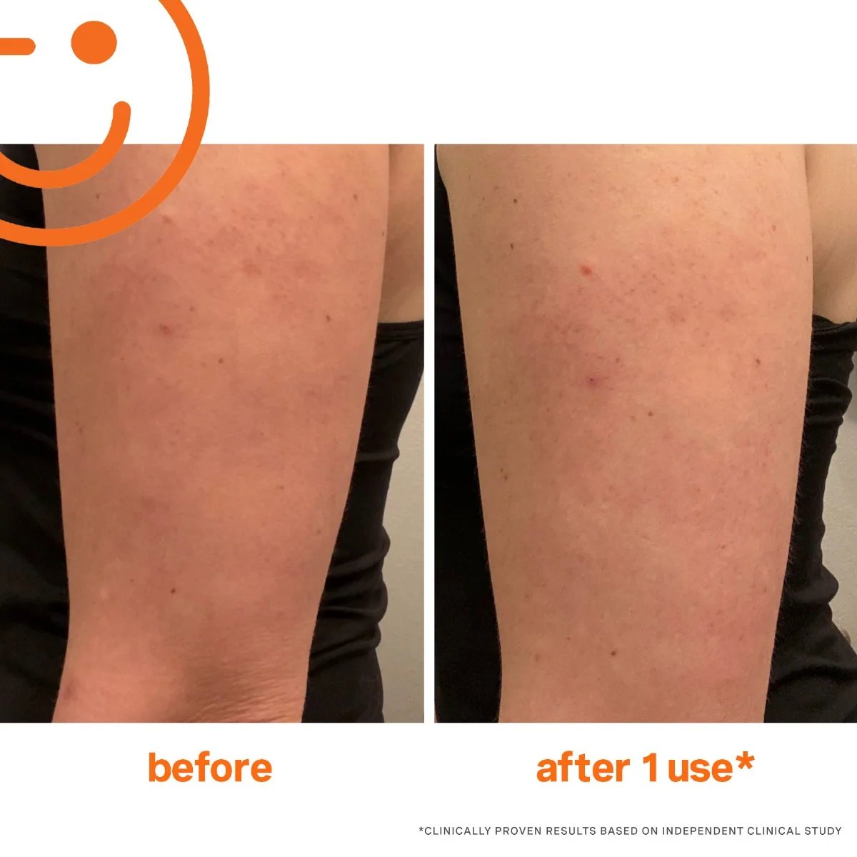 Kate Somerville ExfoliKate Resurfacing Body Scrub 2