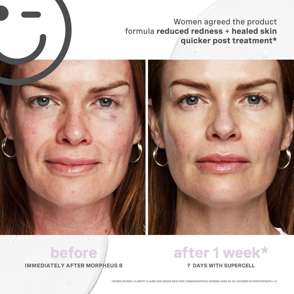Kate Somerville Kateceuticals Supercell Rejuvenation Serum 2