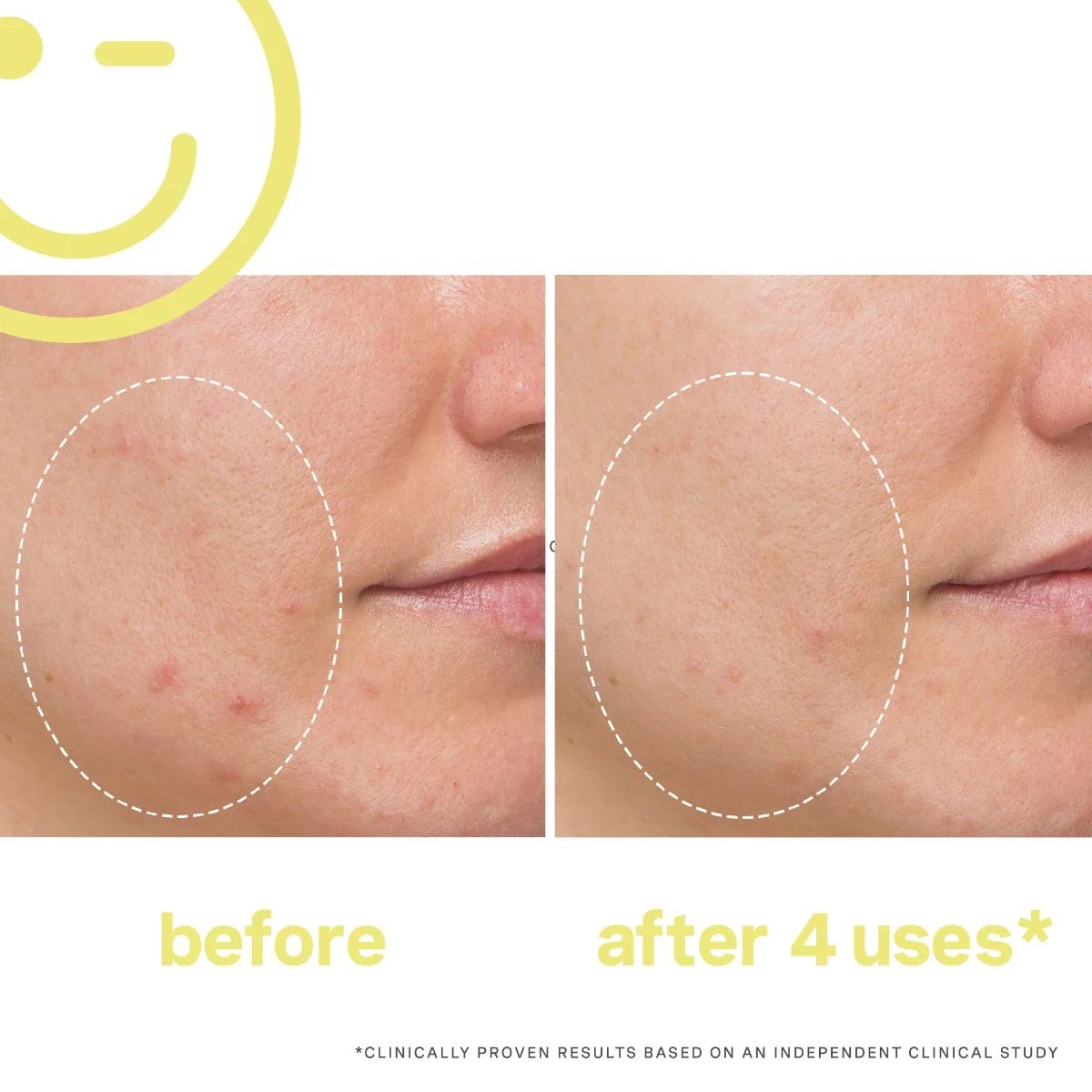 Kate Somerville Mega C 30% Vitamin C Brightening Facial 60ml 2