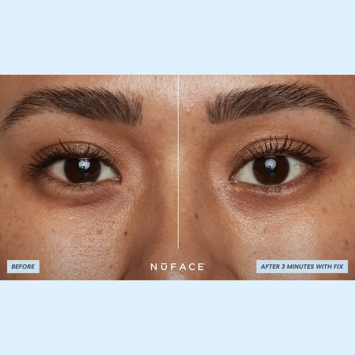 NuFACE IonPlex® Hydra-Gel Power Patches (30 pairs eye patches) 4