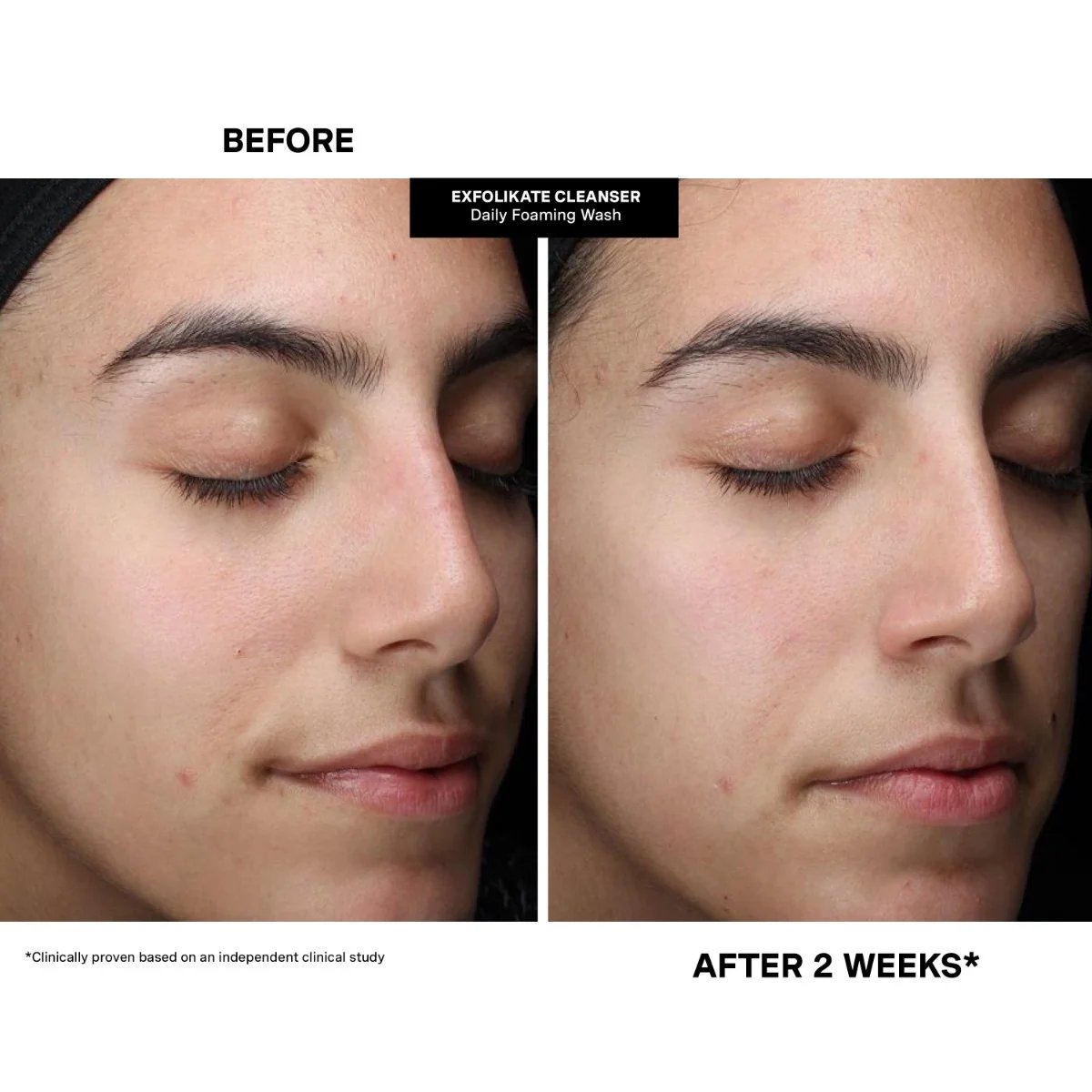 Kate Somerville Pore-fect Holiday Trio 8