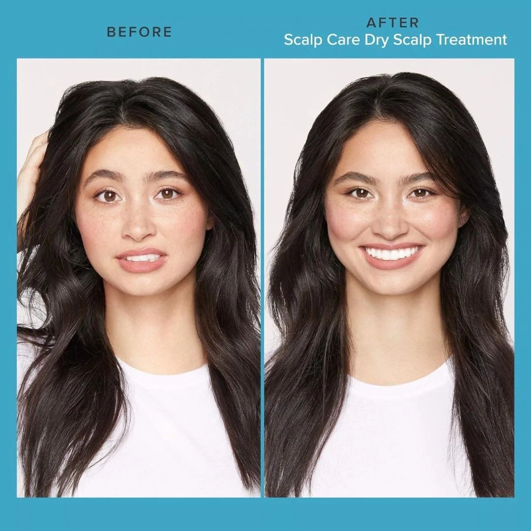 LIVING PROOF Scalp Care Dry Scalp Treatment 2