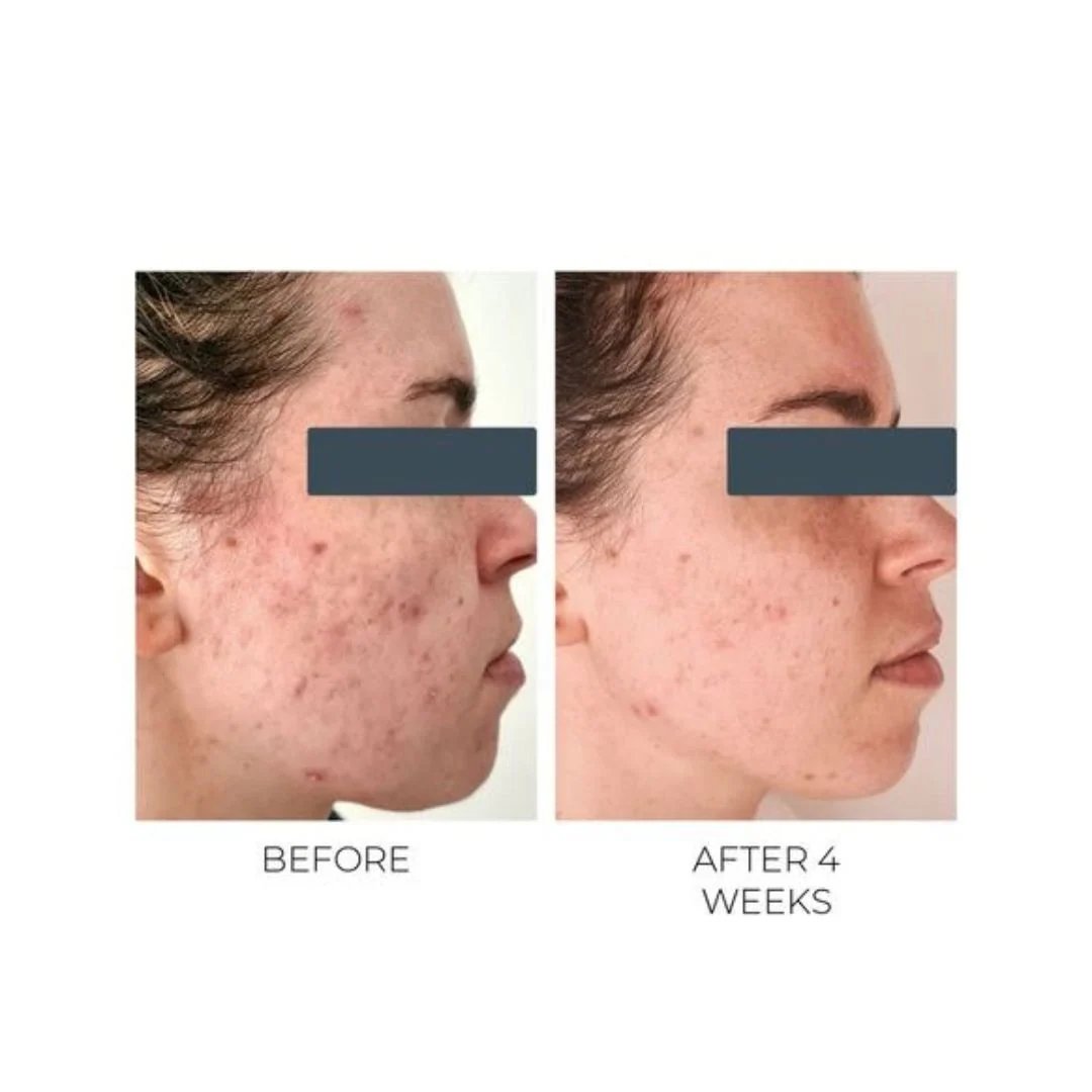 Violet Water D-Spot Clearing Blemish Treatment 20ml 7