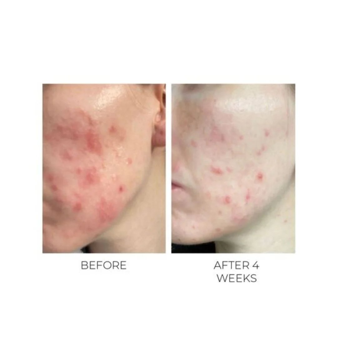 Violet Water D-Spot Clearing Blemish Treatment 20ml 8